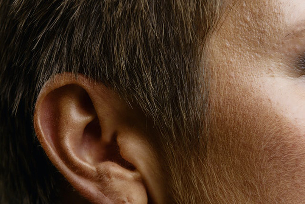 Right Ear