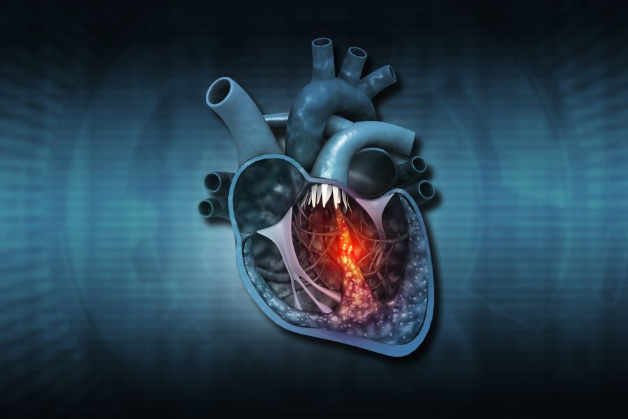Human heart cross section anatomy - stock photo