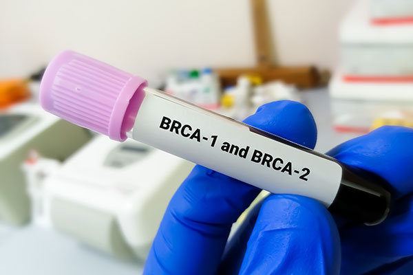 brca