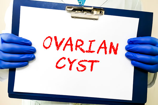 ovarian cyst